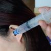 Wolvex Ear Wax Remover Syringe Kit with 3 x Soft Quad-Stream Ear Wax Removal Tips - Reusable Ear Wax Remover - Improves Hearing and Ear Health Naturally - Professional Ear Wax Remover